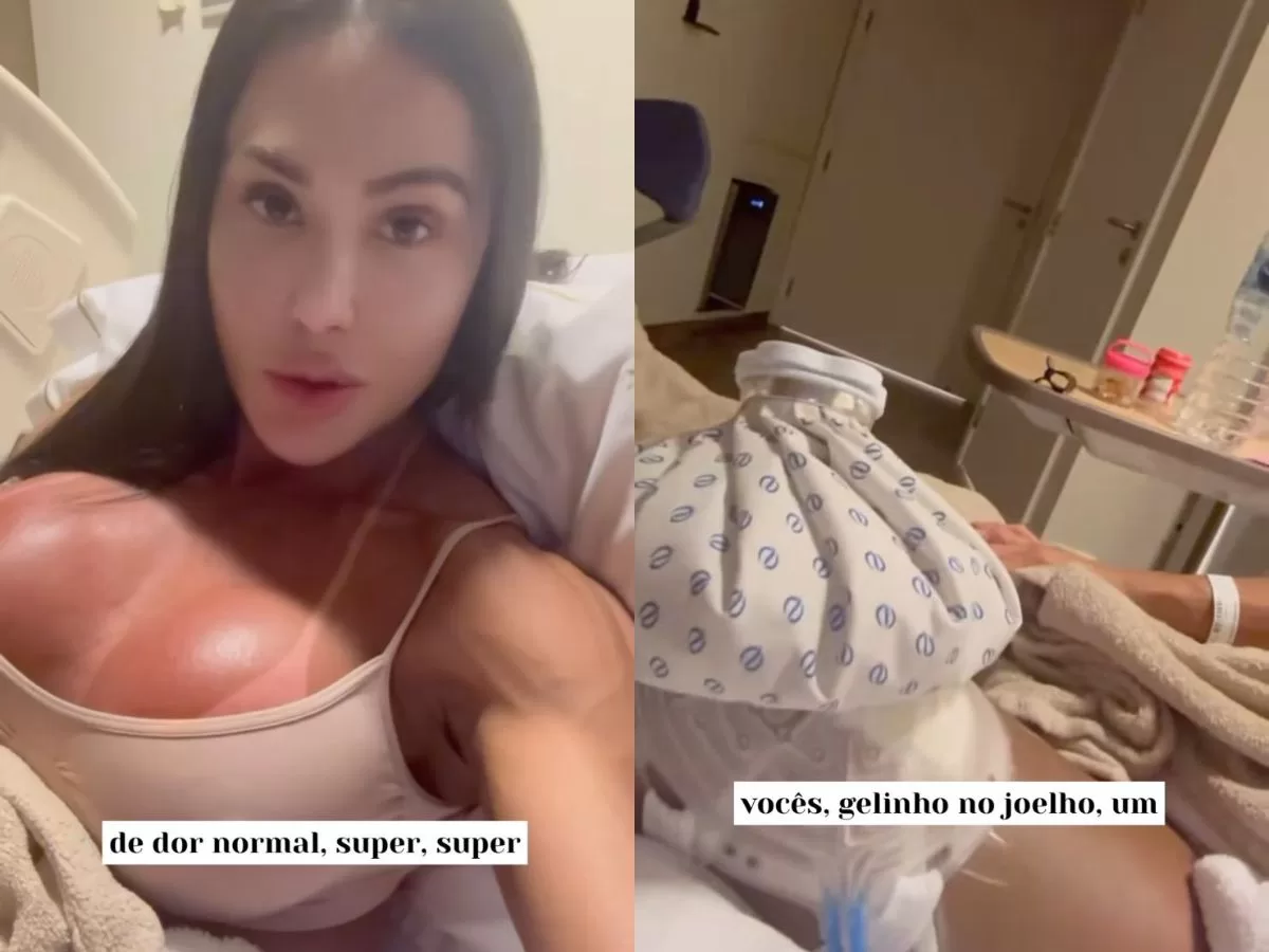 Gracyanne Barbosa ganha quase 20 kg após cirurgia e recebe presente de admirador secreto; saiba tudo!