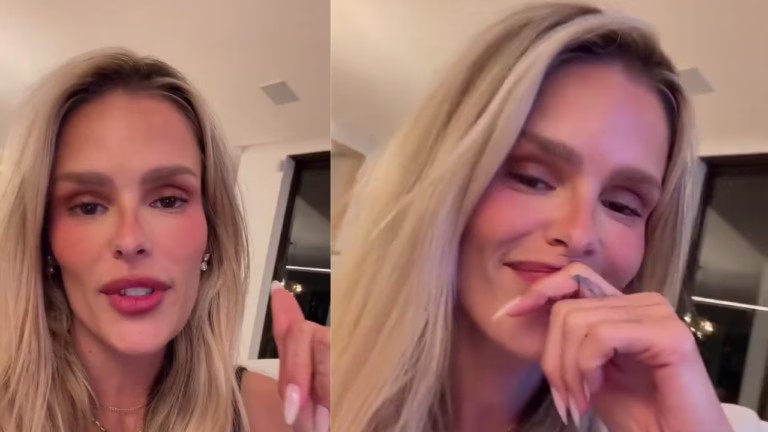 O DIAGNÓSTICO BIZARRO DE YASMIN BRUNET: COMO UM DESCONHECIDO MUDOU A SUA VIDA