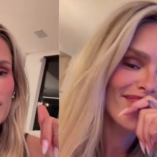 O DIAGNÓSTICO BIZARRO DE YASMIN BRUNET: COMO UM DESCONHECIDO MUDOU A SUA VIDA